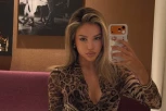 BRESKVICA REŠILA DA IH UKLONI! Pevačica ostaje bez zaštitnog znaka: VIŠE MI NISU LEPE!
