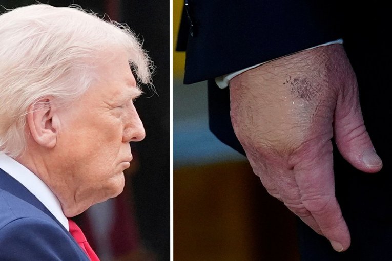 ЧТО ПРОИСХОДИТ СО ЗДОРОВЬЕМ ТРАМПА? Президент США СНОВА идет на медосмотр, Белый дом раскрыл ВСЕ ПОДРОБНОСТИ!