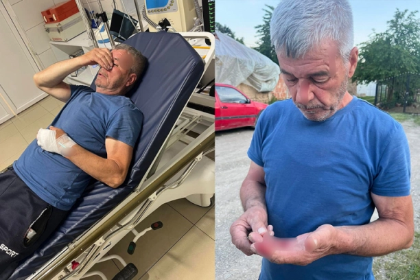 BRUTALAN NAPAD NA SRBINA NA KOSOVU I METOHIJI! Sveta pokušao da obrani sina, a ALBANAC mu naneo strašne povrede! (FOTO)