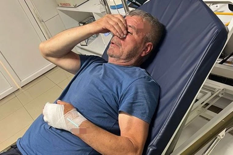 NASTAVLJEN TEROR NAD SRBIMA NA KOSOVU! Evo u kakvom je stanju Sveta koji je brutalno pretučen motkom - NESREĆNI ČOVEK POKUŠAO DA ZAŠTITI SINA OD NASILNIKA!
