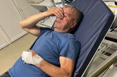 NASTAVLJEN TEROR NAD SRBIMA NA KOSOVU! Evo u kakvom je stanju Sveta koji je brutalno pretučen motkom - NESREĆNI ČOVEK POKUŠAO DA ZAŠTITI SINA OD NASILNIKA!