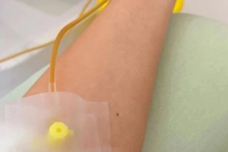 INFUZIJA UMESTO OBROKA?! Opasan trend sa društvenih mreža širi se među mladima u Srbiji