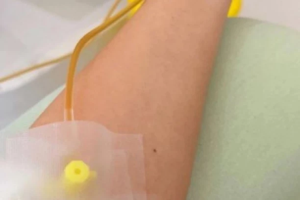 INFUZIJA UMESTO OBROKA?! Opasan trend sa društvenih mreža širi se među mladima u Srbiji