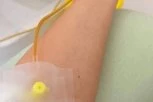 INFUZIJA UMESTO OBROKA?! Opasan trend sa društvenih mreža širi se među mladima u Srbiji