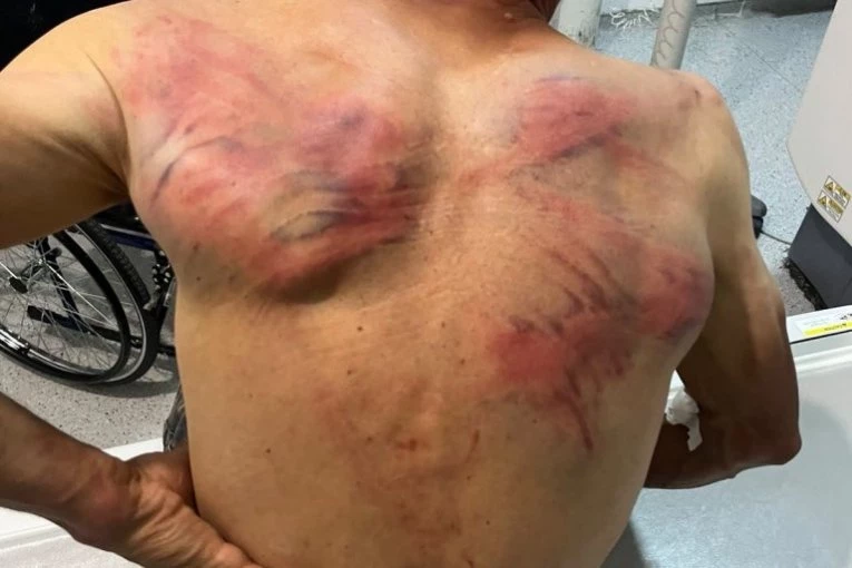 (UZNEMIRUJUĆE FOTOGRAFIJE) KURTIJEVI POLICAJCI OTELI SRBINA, VEZALI GA ZA DRVO I TUKLI DO IZNEMOGLOSTI! Tražili od njega da prizna navodni ratni zločin!