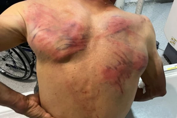 (UZNEMIRUJUĆE FOTOGRAFIJE) KURTIJEVI POLICAJCI OTELI SRBINA, VEZALI GA ZA DRVO I TUKLI DO IZNEMOGLOSTI! Tražili od njega da prizna navodni ratni zločin!