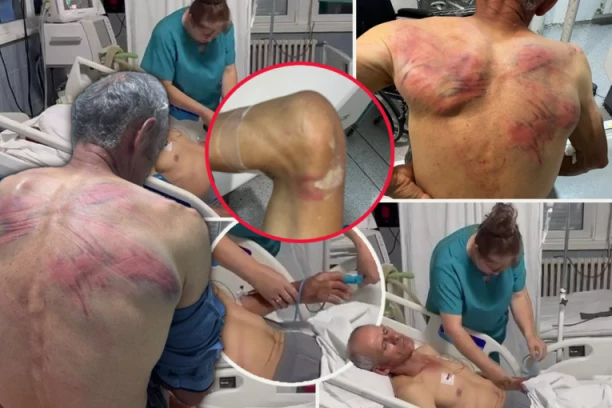 PRVE REČI BRUTALNO PREBIJENOG SRBINA U ZUBINOM POTOKU: "Vezali su me za bukvu, stavili krpu u usta i tukli me crevom - ZATRAŠIVALI SU MI SINA I ŽENU!"
