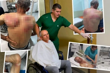"NIJE STABILNO" Elek o stanju pretučenog Raškovića: Ima povrede glave i grudnog koša