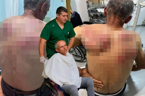 "U ŠOK SOBI JE" Oglasio se lekar o stanju Srbina koga je pretukla Kurtijeva policija: Teško je povređen