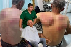 "U ŠOK-SOBI JE!" Oglasio se lekar o stanju Srbina kog je pretukla Kurtijeva policija: Teško je povređen!