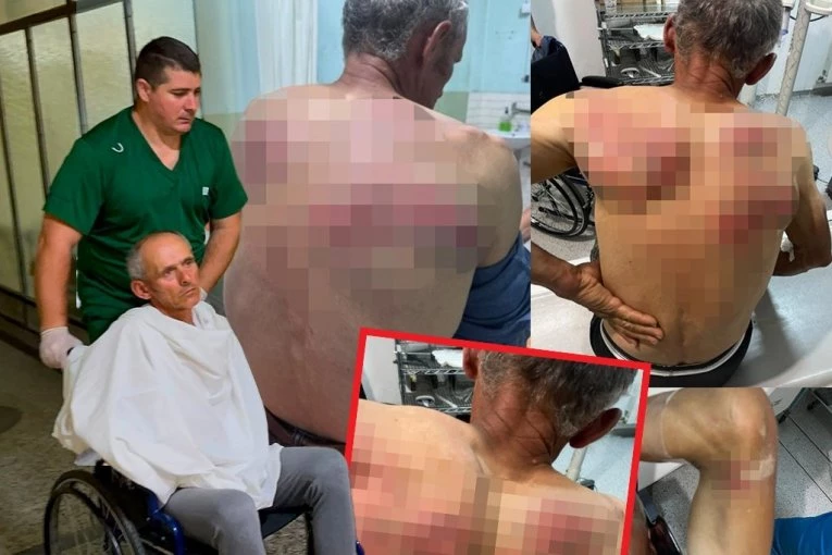 SIMIĆ: Suspenzija nije dovoljna, odgovorni za zlostavljanje Raškovića moraju pred sud