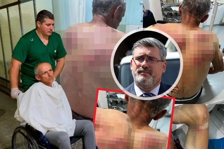 "SLIKA OPHOĐENJA TZV. KOSOVSKE POLICIJE PREMA SRBIMA" Starović o prebijanju Raškovića