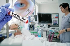 ZARAZA SE ŠIRI PO SRPSKOM KOMŠILUKU! Novi slučaj groznice Zapadnog Nila, broj obolelih povećan na 34