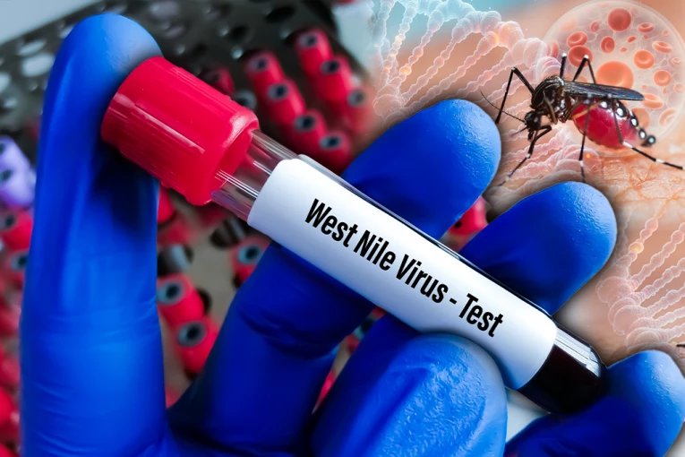 OPASNI VIRUS NE JENJAVA U SRBIJI! "Batut" objavio najnoviji presek, većina obolelih u teškom stanju