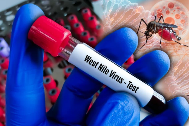 OPASNI VIRUS NE JENJAVA U SRBIJI! "Batut" objavio najnoviji presek, većina obolelih u teškom stanju