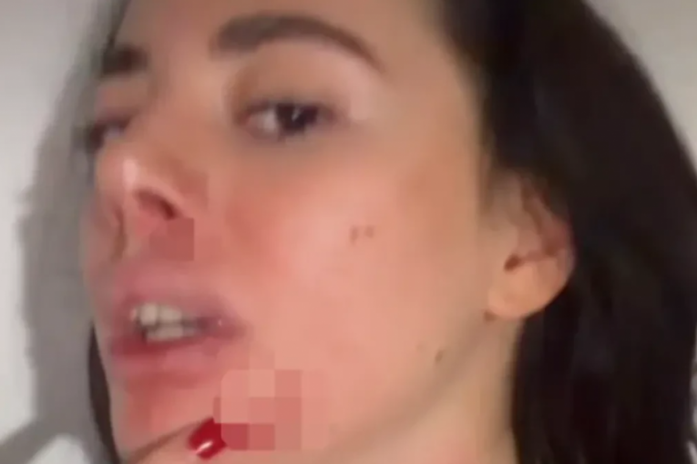 Ivana Keneški pretučena