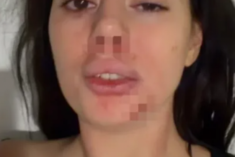 Ivana Keneški pretučena