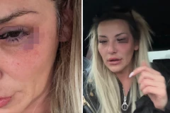 UZNEMIRUJUĆE SCENE! Pevačica pretučena na nastupu, zadobila STRAVIČNE POVREDE GLAVE! (VIDEO)