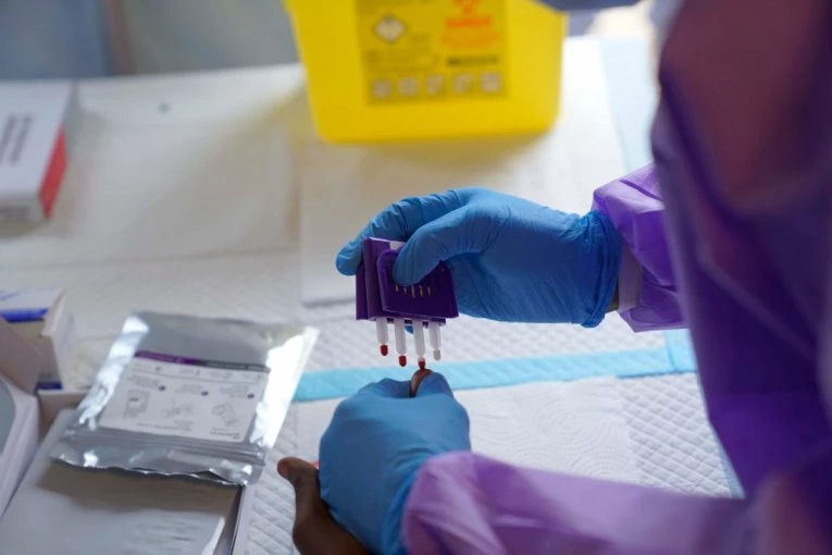 HITNO HOSPITALIZOVAN! Nigerijac primljen u bolnicu u Cirihu zbog sumnje na smrtonosnu bolest!