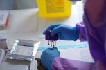 HITNO HOSPITALIZOVAN! Nigerijac primljen u bolnicu u Cirihu zbog sumnje na smrtonosnu bolest!